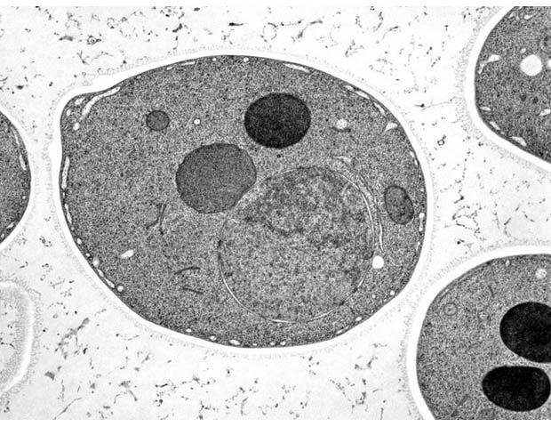 酵母菌（透射电镜）